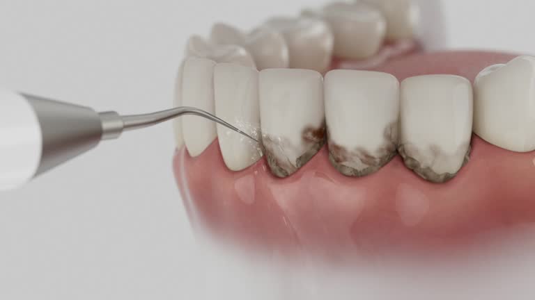 Reliable Tooth Extraction contractor in Fisher County County, TX by Dentist Open Now